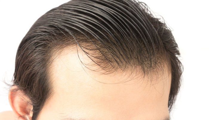 25 Men's Haircuts for Thinning Hair